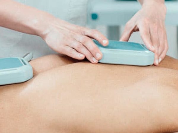 Agulhamento a Seco e Infiltração de Anestésico Local